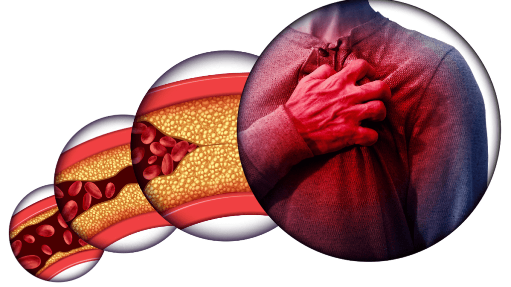 Colesterol: O Guia Completo para Entender, Prevenir e Controlar 2 coleterol