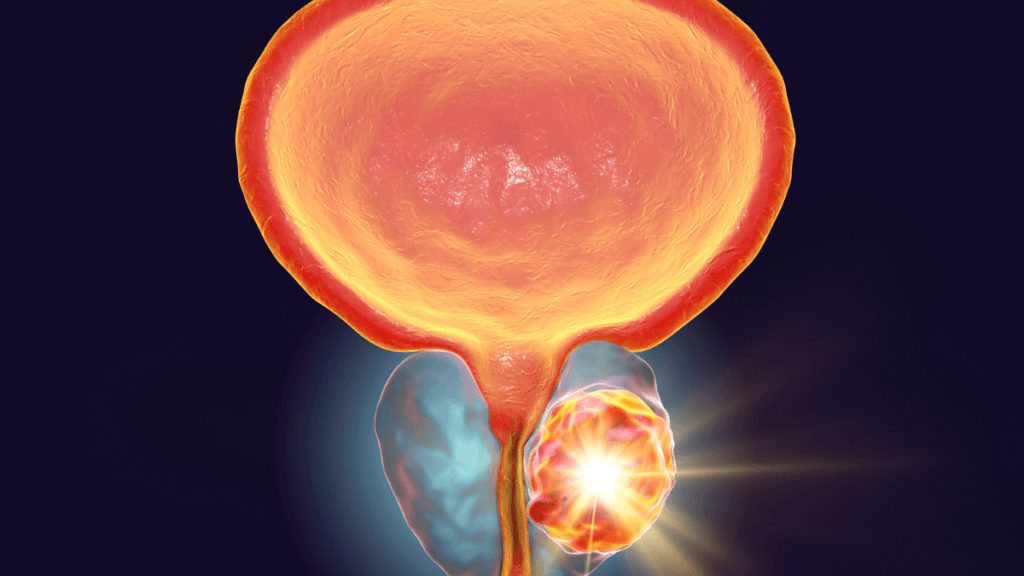 Mais de 10 Benefícios do Abacate para a Saúde da Próstata 3 prostata